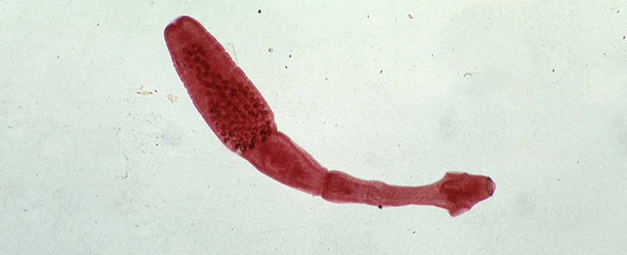 Hydatid tapeworm 