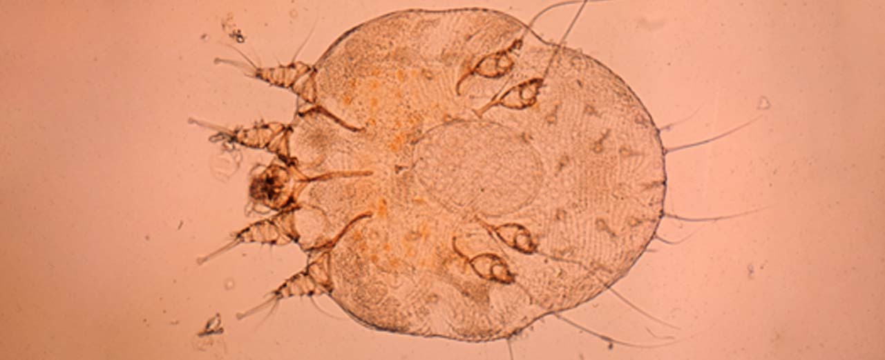 Microscopic image of a Sarcoptes mite 